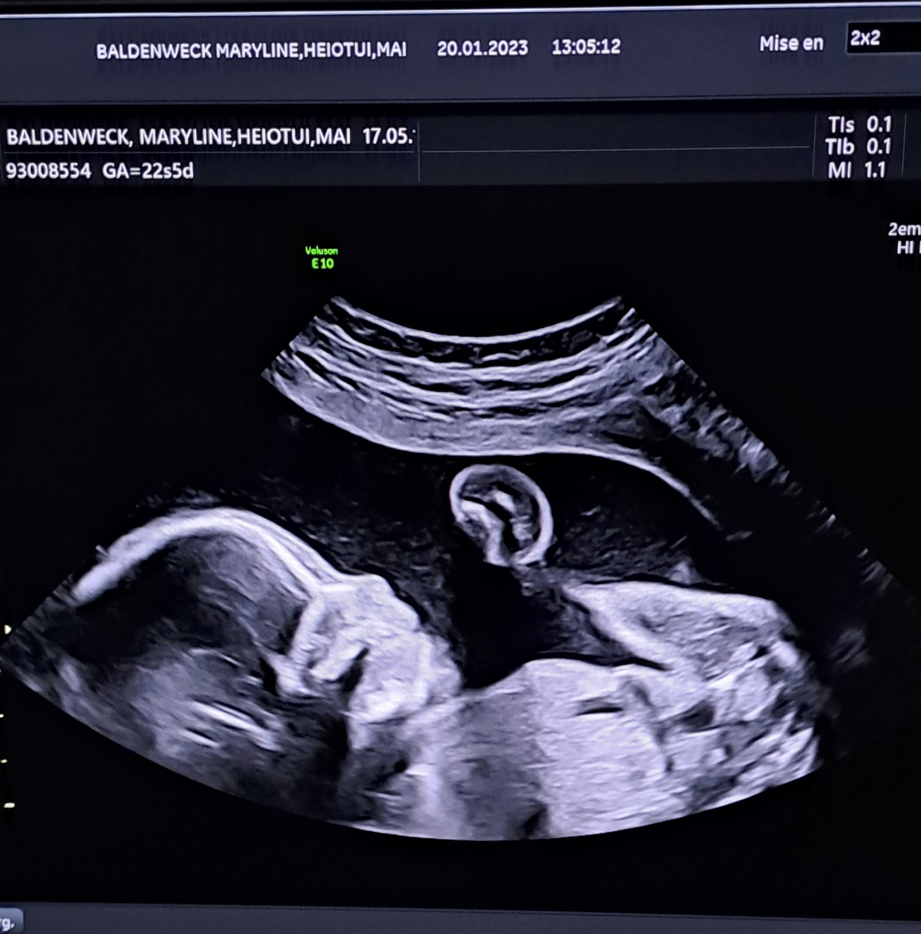 tgl_04bb408e-5721-4dd4-8e68-ce4a8f0dc7a4